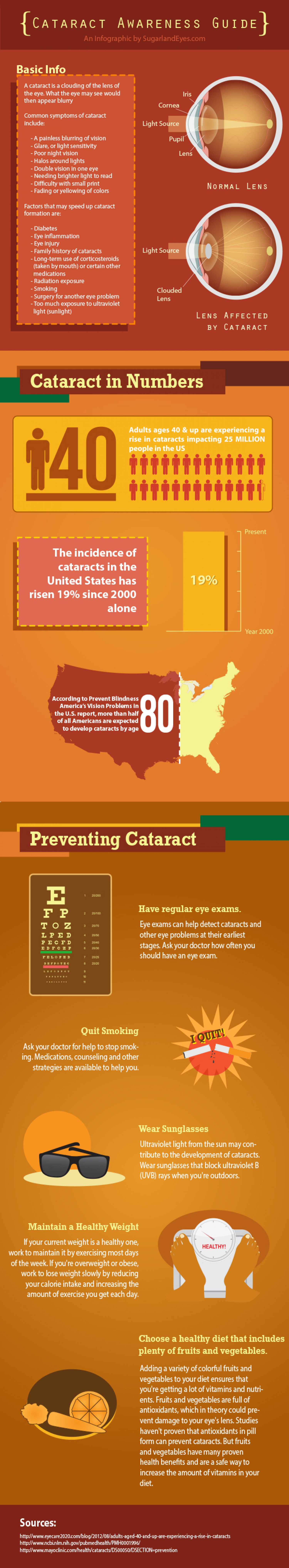 Are You at Risk for Cataracts?
