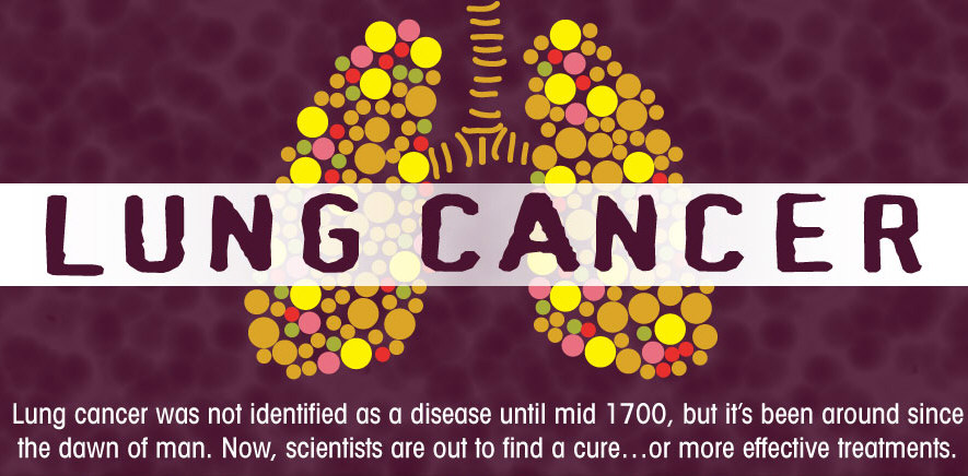 Lung Cancer: History and Hope [Infographic]