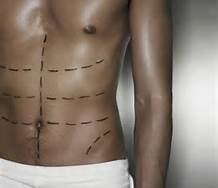 The Truth About Men and Cosmetic Surgery