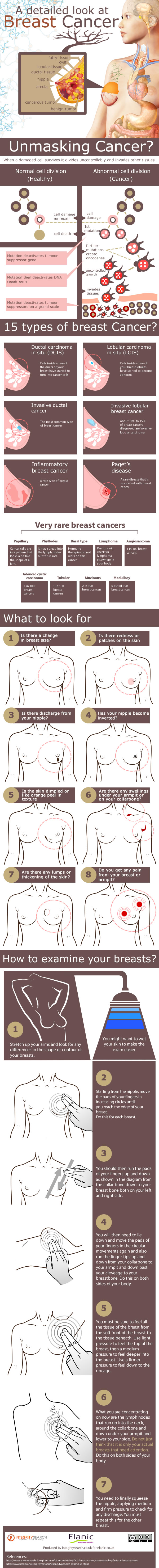 A Detailed Look at Breast Cancer