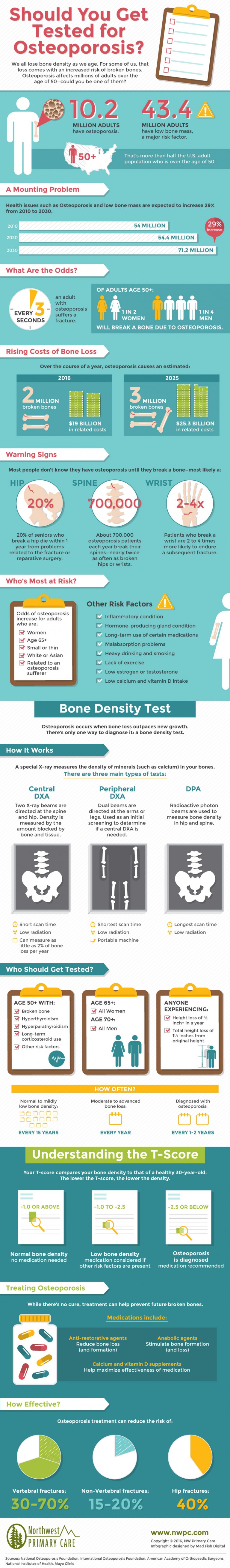 Should You Get Tested for Osteoporosis? [Infographic]