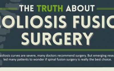 The Truth About Scoliosis Fusion Surgery