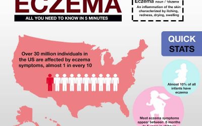 Eczema: All You Need to Know in 5 Minutes