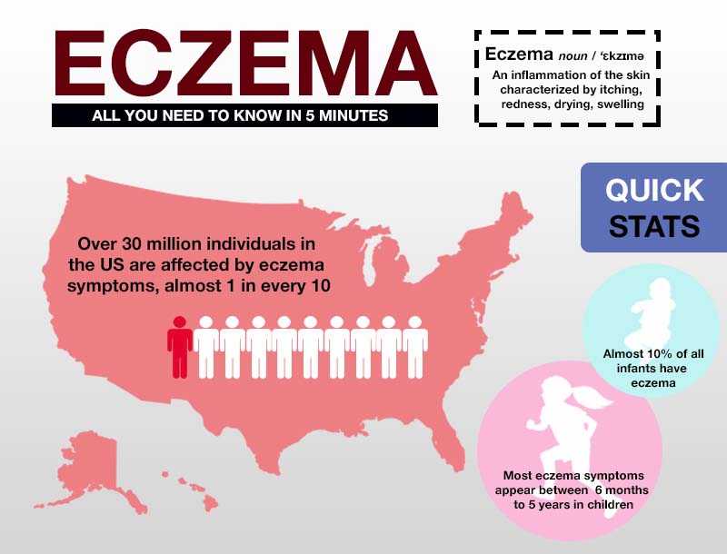 Eczema All You Need To Know In 5 Minutes Infographic