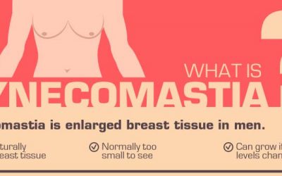 What Is Gynecomastia?