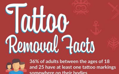 Interesting Facts About Laser Tattoo Removal