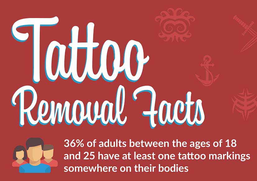 Facts About Tattoo Removal Home Design Ideas