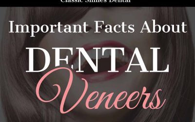 Important Facts About Dental Veneers