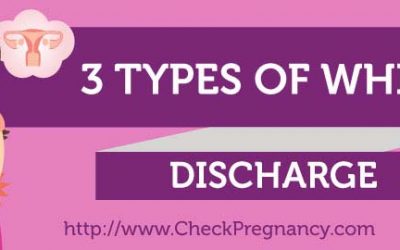 Thick White Vaginal Discharge: 3 Types & What They Mean?