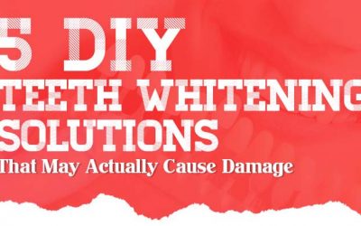 DIY Teeth Whitening Solutions That May Actually Cause Damage