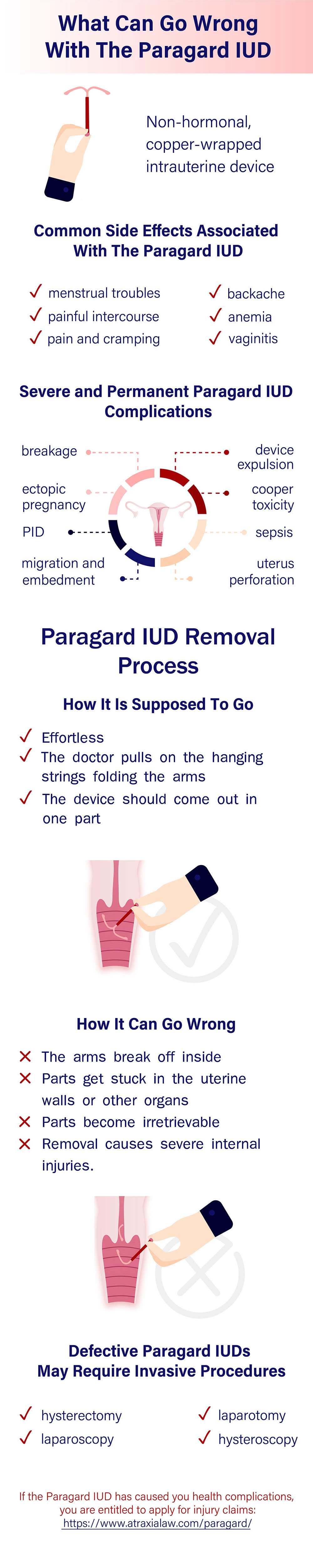 paragard iud side effects