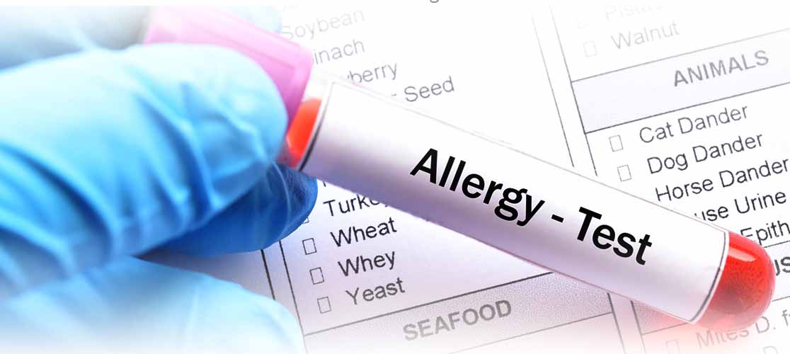 Food Allergy Testing – Diagnosing Your Allergy (Infographic)